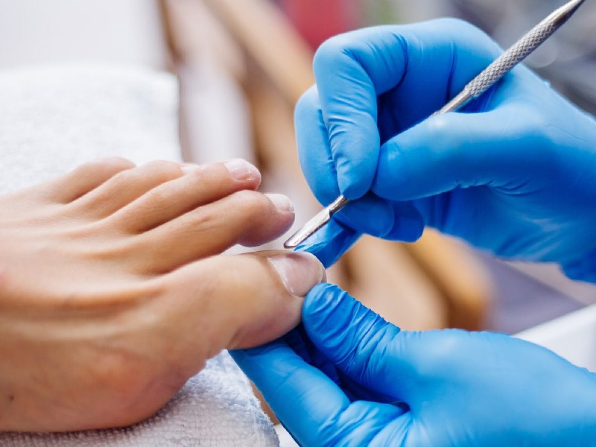 Nail Care